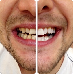 before-after-3